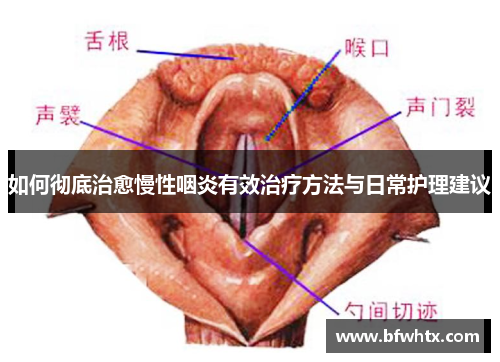 如何彻底治愈慢性咽炎有效治疗方法与日常护理建议